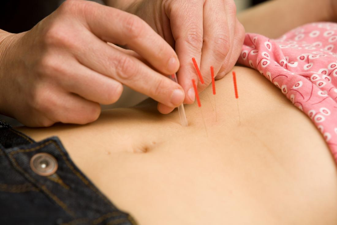 Acupuncture for Women’s Health & Fertility Support in Boca Raton Women’s health is deeply connected to hormonal balance, stress levels, and overall well-being.
